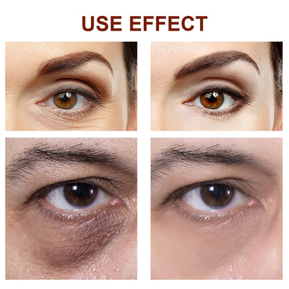 Naturkosmo Straffende Augencreme mit Schlangengift-Komplex – Gegen Augenringe & Tränensäcke, Lifting-Effekt, 30 g