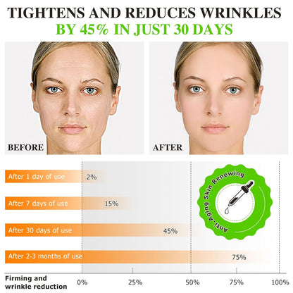 Vitamin C Serum Face 60 ml - 20% Vitamin C Serum High Dose with Vitamin E & Hyaluronic Acid | Anti-Ageing & Skin Renewal | Skin Whitening & Moisturising Serum Vitamin C for Face | Fragrance-Free