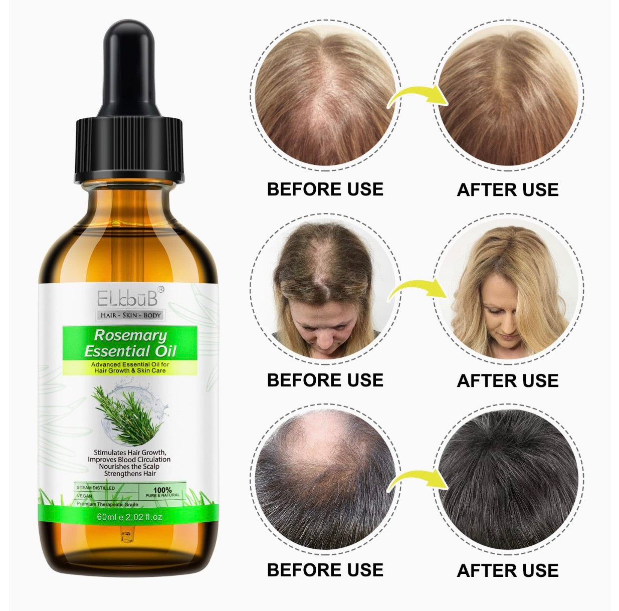 Rosemary Essential Oil for Scalp and Hair, Strengthening Oil for Scalp Care, Strengthens Hair, Stimulates Hair Growth for Men and Women, 60 ml