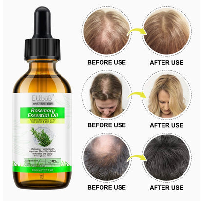 Rosemary Essential Oil for Scalp and Hair, Strengthening Oil for Scalp Care, Strengthens Hair, Stimulates Hair Growth for Men and Women, 60 ml